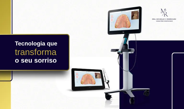 Escaneamento iTero para simulação do sorriso no tratamento com Invisalign